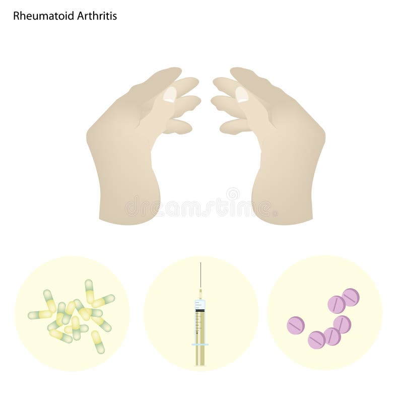 手指联接风湿性关节炎与疾病治疗的.